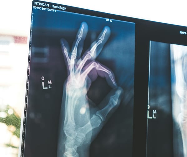 Exploring Practical Barriers to the Adoption of AI-based Application in Swiss Healthcare